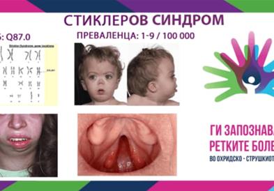 „Ги запознаваме ретките болести“ - Стиклеров синдром