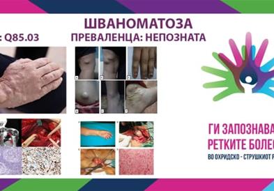 „Ги запознаваме ретките болести“ - Шваноматоза