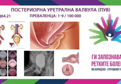 „Ги запознаваме ретките болести“ - Постериорна уретрална валвула