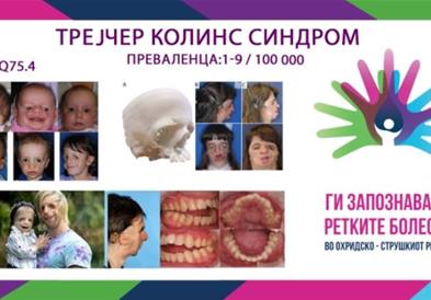 „Ги запознаваме ретките болести“ - Трејчер Колинс синдром (ТКС)