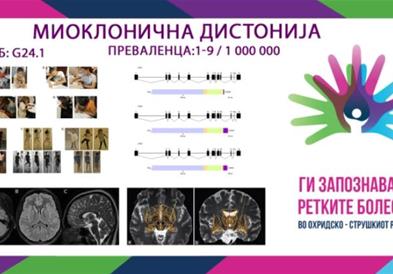 „Ги запознаваме ретките болести“ - Миоклонична дистонија