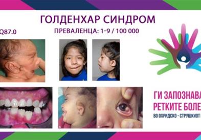„Ги запознаваме ретките болести“ - Голденхар синдром