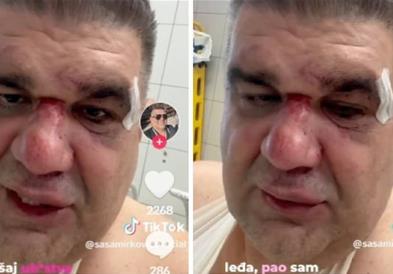 Се огласи претепаниот српски бизнисмен во Загреб: Ме тепаше менаџерот на Цеца (ВИДЕО)