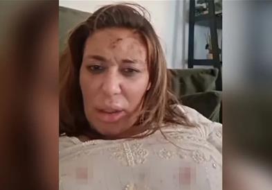 Ана Николиќ претепана од нејзиниот партнер, српската пејачка објави шокантна снимка (ВИДЕО)