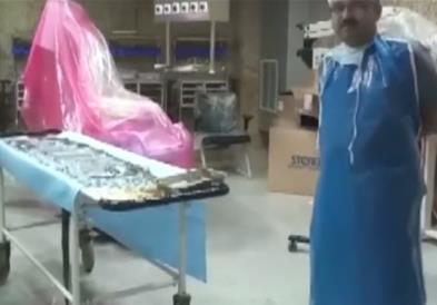 Се пожалила на силна болка во стомакот- докторите се шокирале кога извадиле 1,5 килограми накит (ВИДЕО)