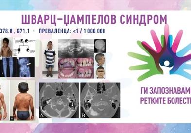 „Ги запознаваме ретките болести“: Шварц-џампелов синдром/Хондродистрофична миотонија/SCHWARTZ–JAMPEL SYNDROME