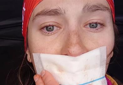 Наместо да оди на Олимписките игри, биатлонка морала да ја заврши кариерата поради трансплантација на јазик 
