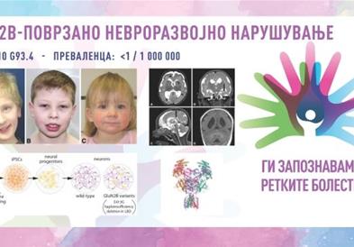 „Ги запознаваме ретките болести“: GRIN2B-поврзано невроразвојно нарушување