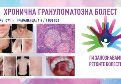 „Ги запознаваме ретките болести“: Хронична грануломатозна болест