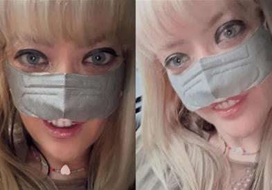 Отишла во Турција за да си ги среди забите, сега не може да дише- сменет ѝ е личниот опис (ВИДЕО)