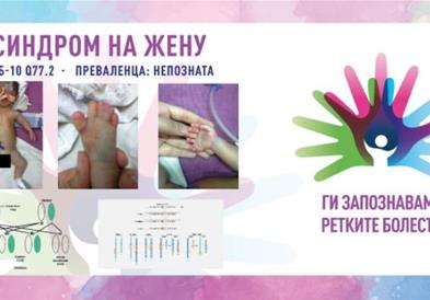 „Ги запознаваме ретките болести“: Синдром на жену
