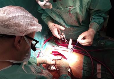 Во Битола се одржа трибина за подигнување на свесноста за важноста на органодарителството 