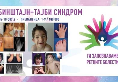 „Ги запознаваме ретките болести“: Рубинштајн–Тајби синдром