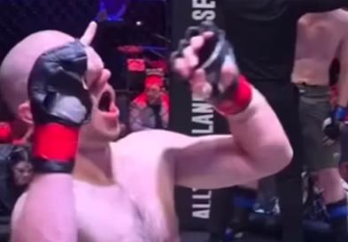 ММА борач ја скрши раката во борба, па откако победи сфати дека е тешко повреден (Вознемирувачко видео) 