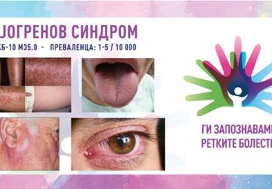 „Ги запознаваме ретките болести“: Сјогренов синдром