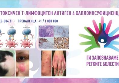 „Ги запознаваме ретките болести“: Цитотоксичен т-лимфоцитен антиген 4 хаплоинсуфициенција