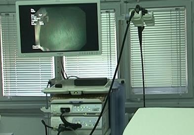 Ракот на дебелото црево сè почест кај помладите