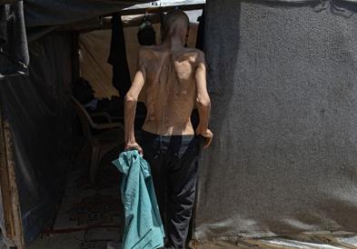 ГНАФЦ: За 10 години двојно е зголемен бројот на луѓе кои страдаат од глад 