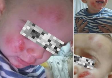 Потресно сведоштво на мајка: Агресивни кучиња ми ги нападнаа децата (ФОТО)