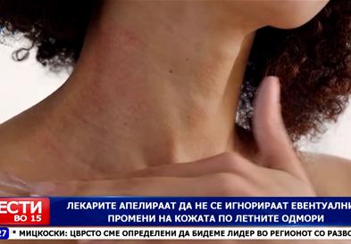 Лекарите апелираат да не се игнорираат евентуалните промени на кожата по летните одмори