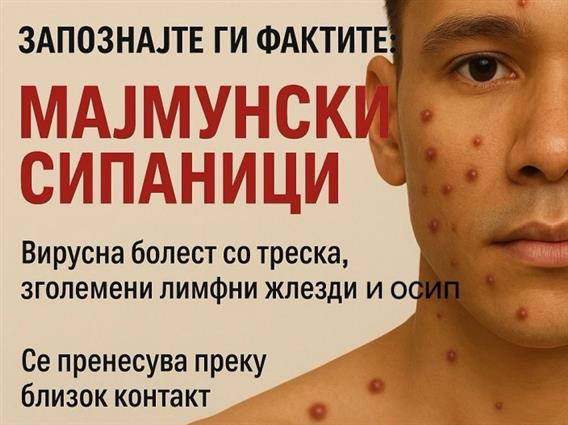 Мајмунски сипаници во Македонија - епидемиологот Даниловски вели дека не се пренесуваат лесно 