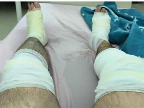 Вкупно 13 повредени во пожарот во Виница се однесени во болниците во Штип, Кочани и Скопје, меѓу нив и пожарникарка  