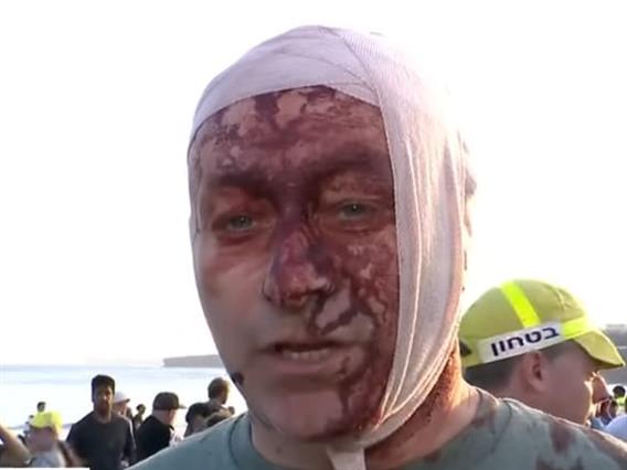 Сведоци на масакрот во Сиднеј: Видовме многу крв и илјадници луѓе како бегаат (ВИДЕО)