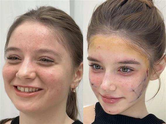 Жени масовно одат во Шангај за да се оперираат и да изгледаат како 13-годишни девојчиња!