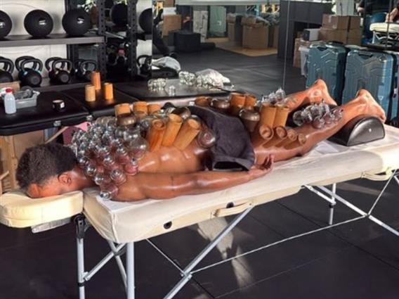 Фото: Вака, ѕвезда на Јувентус се рехабилитира по тежок меч