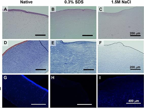 Македонски научници во Норвешка развиваат иновативна и 3Д-принтана рожница за трансплантација