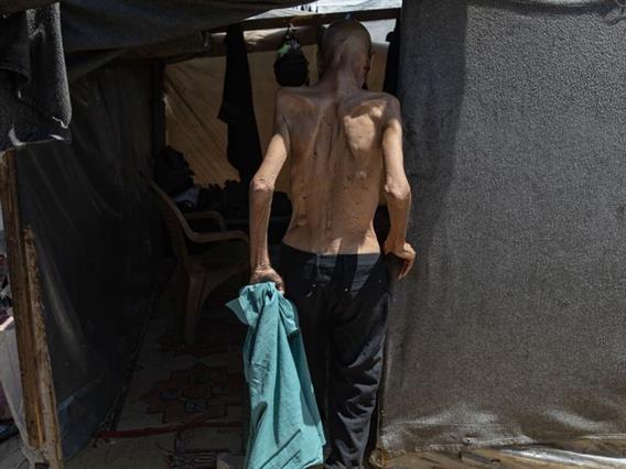 ГНАФЦ: За 10 години двојно е зголемен бројот на луѓе кои страдаат од глад 