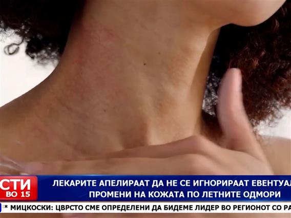Лекарите апелираат да не се игнорираат евентуалните промени на кожата по летните одмори