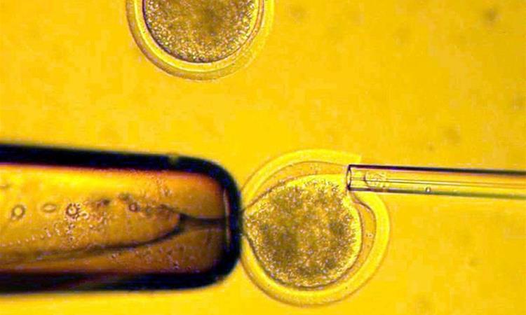 Научниците успеаја да ги „подмладат“ човечките јајце- клетки, револуционерно откритие при ин витро оплодување на постарите жени 