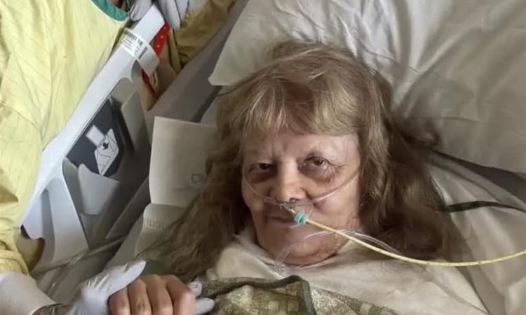 Жена од Аризона заспала на сонце, едвај преживеала