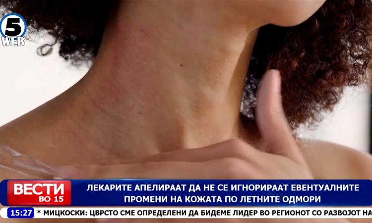 Лекарите апелираат да не се игнорираат евентуалните промени на кожата по летните одмори