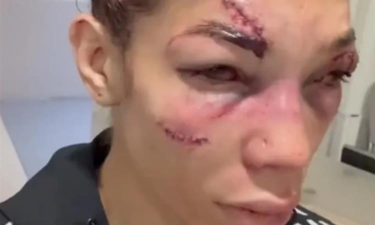 Софија Монтенегро е непрепознатлива по борбата во Париз (Вознемирувачко видео) 