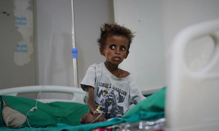 „WFP“: Гладот ​​се влошува
