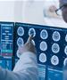 Научниците со шокантно откритие: Човечкиот мозок во еден случај се „јаде“ самиот себе