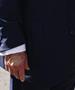 Трамп оди на лекарски преглед, негови фотографии со модринки се шират на интернет