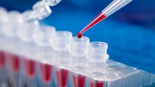 Во БиХ од Ковид-19 вкупно заразени 1.077, досега починале 39 лица