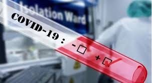 Тешка состојба на паценти од Ковид-19 може да има и кај помлади лица
