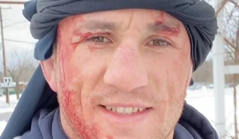 УФЦ борец се фрли во замрзнато езеро и заврши во болница (ВИДЕО)
