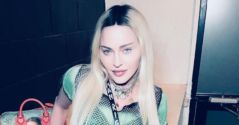 Мадона објави серија разголени снимки, фановите ја критикуваат за операциите (ФОТО)