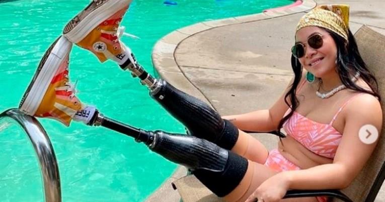 Ги изгубила нозете кога родителите и се разнеле со бомба, сега е параолимпијка и манекенка 