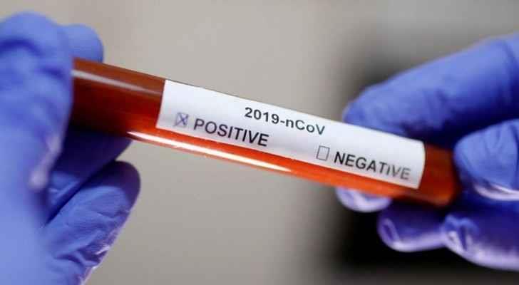 Регистрирани се 978 нови случаи на Ковид -19, починале 24 заболени 