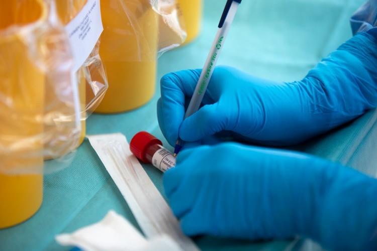 Србија: 42 починати, 6129 новозаболени