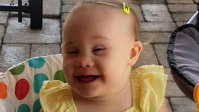 Родители занемариле 4-годишно девојче со Даунов синдром