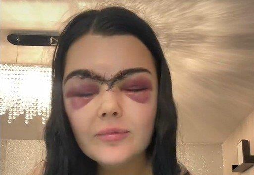 Девојка џокеј се шокирала од својот одраз во огледало по бизарната несреќа