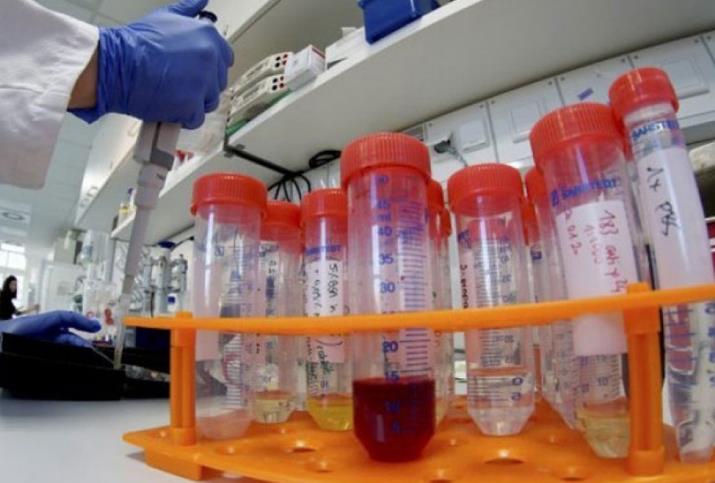 Србија: 44 починати, 2130 новозаболени 
