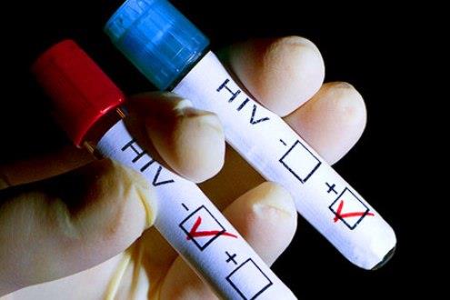 Буџетот за превенција од ХИВ намален за 40 отсто